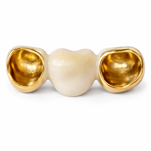 PFM Gold