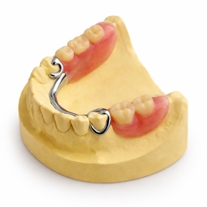 Partial Denture (1-13 teeth)