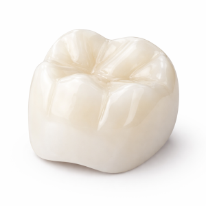 Solid Zirconia Crowns, Inlays, Onlays