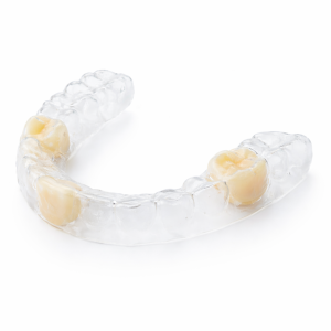 Essix Retainer