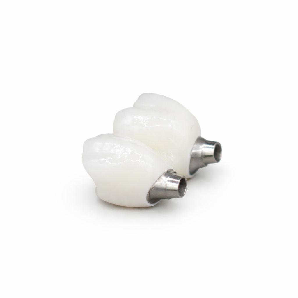 implant bridge